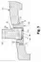 Fig. 04 - Tip shroud attachment for stator vane