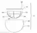 Fig. 01 - Method of sterilizing an orthopaedic implant