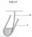 Fig. 18 - Specimen analyzer and specimen suction device