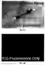 Fig. 06 - Intraoperative determination of nerve location