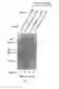 Fig. 10 - Chimeric cytokine of IL-7 and beta-chain of HGF and methods of use