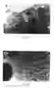 Fig. 07 - Method for regulating neuron development and maintenance