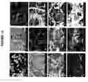Fig. 17 - Tissue graft compositions and methods for producing same
