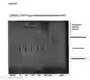 Fig. 45 - Method of using lipid acyltransferase