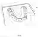 Fig. 05 - Thermoforming plastic type II
