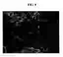 Fig. 09 - Negative active material including Si active metal grains and Cu—Al metal matrix surrounding Si active metal grains and rechargeable lithium battery including negative active material