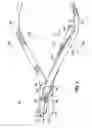 Fig. 02 - Debonding pliers