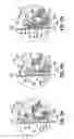 Fig. 07 - Debonding pliers