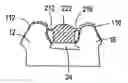 Fig. 01 - Manufacture of dental prostheses