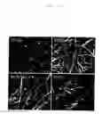 Fig. 11 - Method of preparing basement membrane, method of constructing basement membrane specimen, reconstituted artificial tissue using the basement membrane specimen and process for producing the same