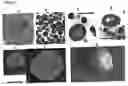 Fig. 02 - Methods for isolating proteons from plasma samples