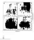 Fig. 02 - Brain tumor marker and method of diagnosing brain tumor
