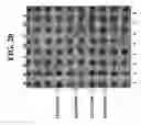 Fig. 34 - Methods for detection of genetic disorders