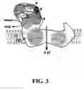 Fig. 04 - Mitochondrial markers of ischemia