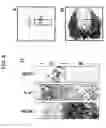 Fig. 09 - GENE SPECIFICALLY EXPRESSED IN POSTMITOTIC DOPAMINERGIC NEURON PRECURSOR CELLS