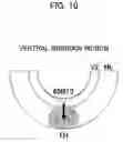 Fig. 11 - GENE SPECIFICALLY EXPRESSED IN POSTMITOTIC DOPAMINERGIC NEURON PRECURSOR CELLS