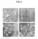 Fig. 07 - Method for isolating and culturing multipotent progenitor cells from umbilical cord blood