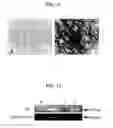 Fig. 11 - Method for isolating and culturing multipotent progenitor cells from umbilical cord blood