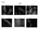 Fig. 08 - AMNIOTIC FLUID DERIVED CELLS