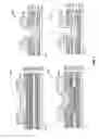 Fig. 03 - Thin-film transistor and diode array for an imager panel or the like