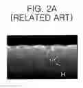 Fig. 03 - Method for fabricating semiconductor device having flask type recess gate