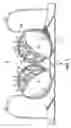 Fig. 06 - Brassiere frame