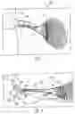 Fig. 02 - Tennis training aid