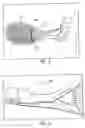 Fig. 03 - Tennis training aid