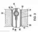 Fig. 04 - Sports racquet with multi-section frame