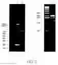 Fig. 03 - Contortrostatin (CN) and methods for its use in preventing metastasis and other conditions