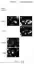 Fig. 23 - Contortrostatin (CN) and methods for its use in preventing metastasis and other conditions