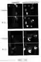 Fig. 24 - Contortrostatin (CN) and methods for its use in preventing metastasis and other conditions