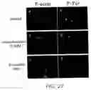 Fig. 25 - Contortrostatin (CN) and methods for its use in preventing metastasis and other conditions