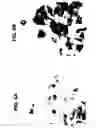 Fig. 06 - Method for treating atherosclerosis or restenosis using microtubule stabilizing agent