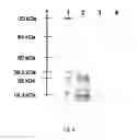 Fig. 05 - Protein-polymer conjugates and synthesis thereof