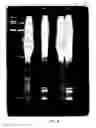 Fig. 05 - Processes for removing cells and cell debris from tissue and tissue constructs used in transplantation and tissue reconstruction