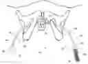 Fig. 01 - Devices for minimally invasive pelvic surgery