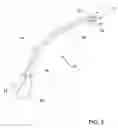 Fig. 03 - Devices for minimally invasive pelvic surgery