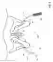 Fig. 06 - Devices for minimally invasive pelvic surgery