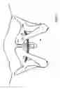 Fig. 07 - Devices for minimally invasive pelvic surgery