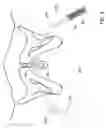 Fig. 09 - Devices for minimally invasive pelvic surgery