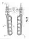 Fig. 05 - Method and apparatus for temporarily immobilizing a local area of tissue