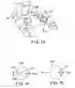 Fig. 15 - Method and apparatus for temporarily immobilizing a local area of tissue