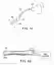 Fig. 22 - Method and apparatus for temporarily immobilizing a local area of tissue