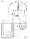 Fig. 06 - Determination of sleep quality for neurological disorders