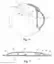Fig. 05 - Intraocular pressure sensor and method of use