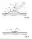 Fig. 12 - Intraocular pressure sensor and method of use