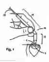 Fig. 02 - Tonometer-pachymeter apparatus for measurement of intraocular pressure