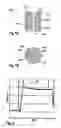 Fig. 07 - Tonometer-pachymeter apparatus for measurement of intraocular pressure