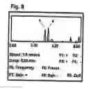 Fig. 08 - Tonometer-pachymeter apparatus for measurement of intraocular pressure